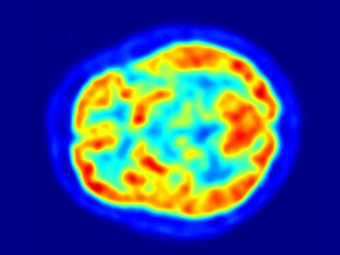 Antimatter